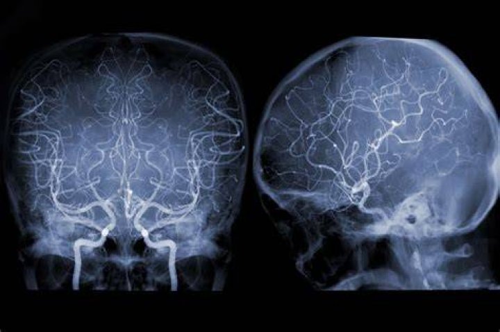 نشرة دواء فاسكولار Vascular لتحسين الدورة الدموية