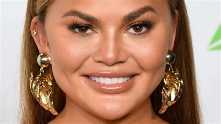 Chrissy Teigen Opens Up About Her Recent Plastic Surgery