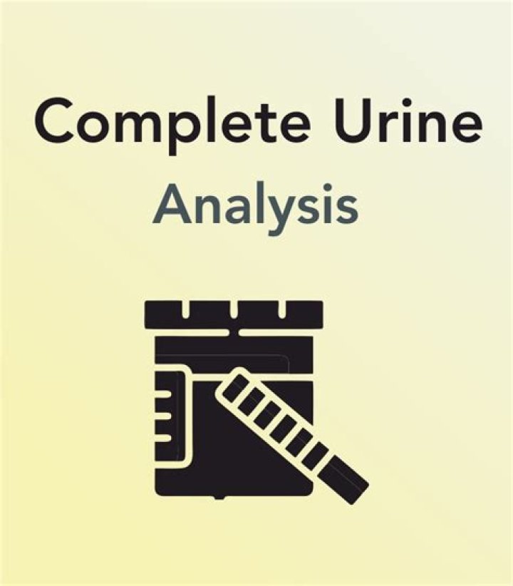 تحليل البول الكامل Complete Urine Analysis