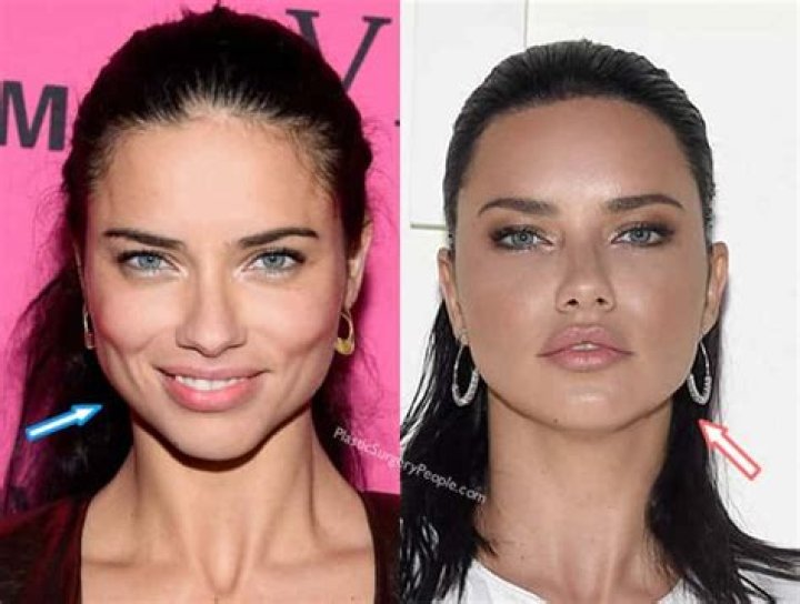 Did Adriana Lima Have Plastic Surgery? (Before & After 2020) (2022)