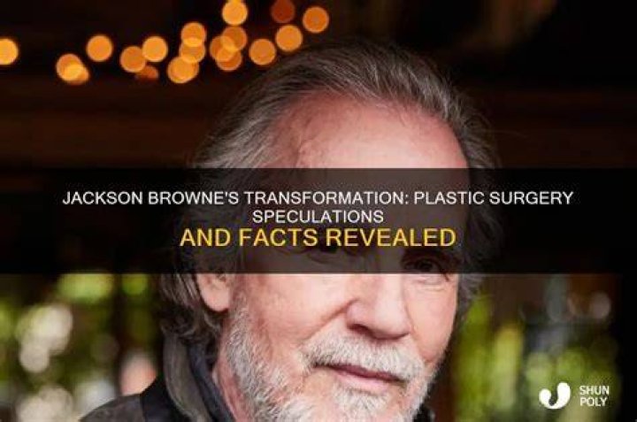 Did Jackson Browne Undergo Plastic Surgery? Family And Net Worth