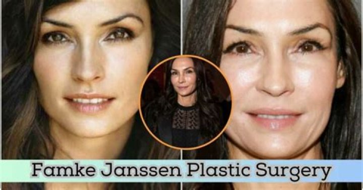 Famke Janssen Plastic Surgery A Look At Her Transformation After And