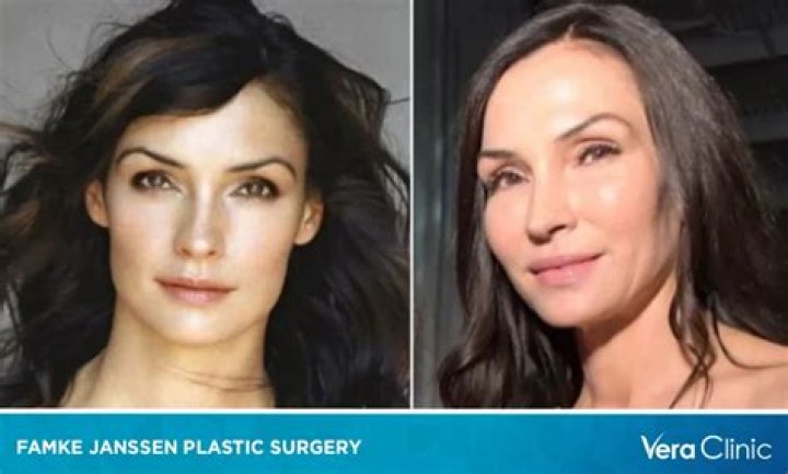 Famke Janssen’s plastic surgery Famke Janssen’s plastic surgery