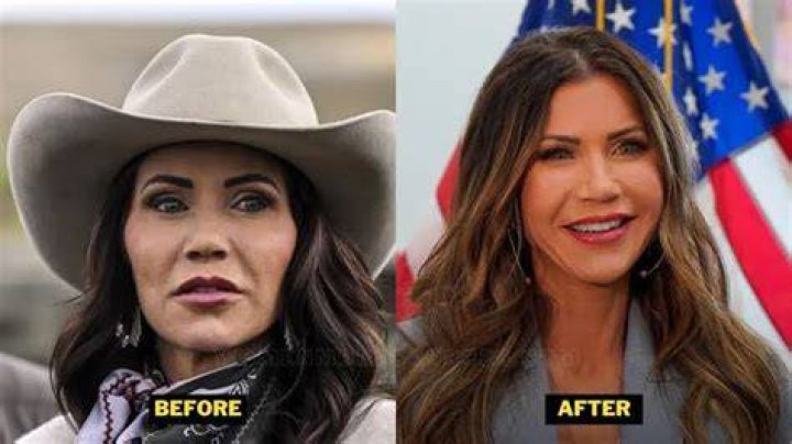 Kristi Noem Plastic Surgery Kristi Noem Stock Photos And Pictures