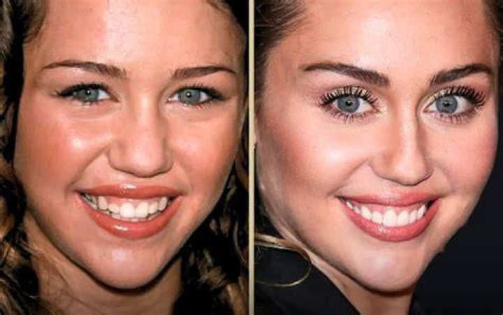 Miley Cyrus' teeth transformation: Before and after