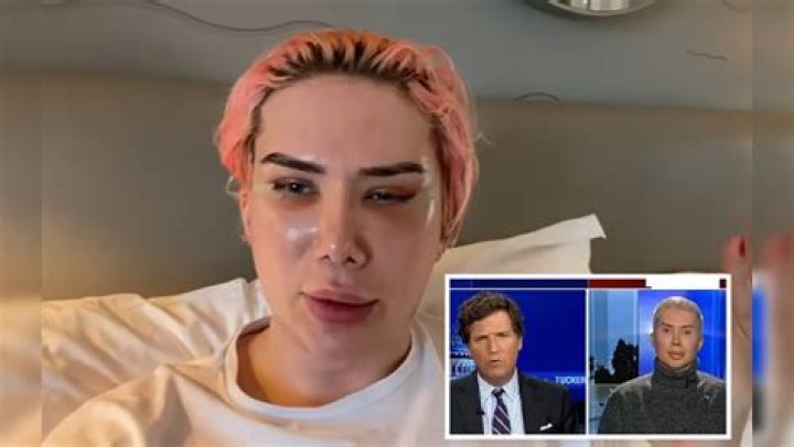 Oli London: Man Identifies as Korean After 18 Surgeries to Look Like BTS Singer