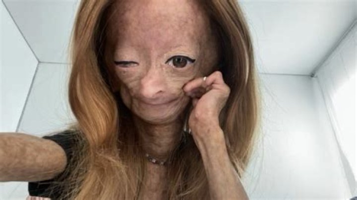 The Heartbreaking Death Of Social-Media Star Adalia Rose Williams