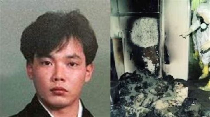 The Tragic Case Of Hisashi Ouchi Radiation Burns And The Worst