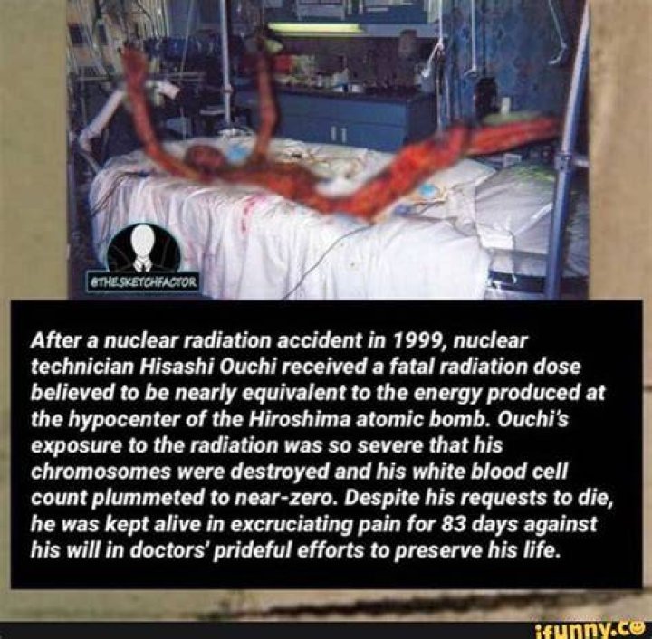 Understanding Hisashi Radiation Progression: A Comprehensive Guide