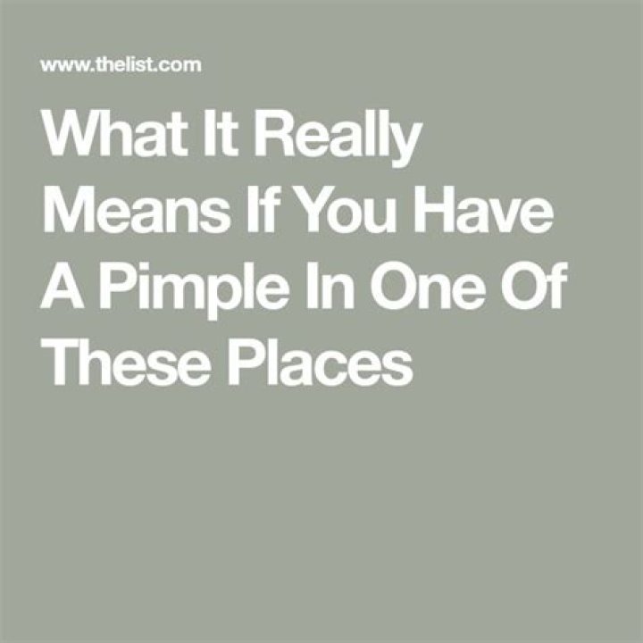 What It Really Means If You Have A Pimple In One Of These Places