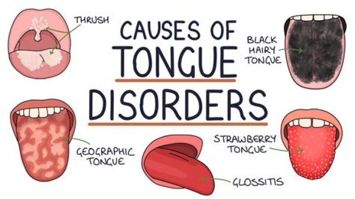 What It Really Means When Your Tongue Itches